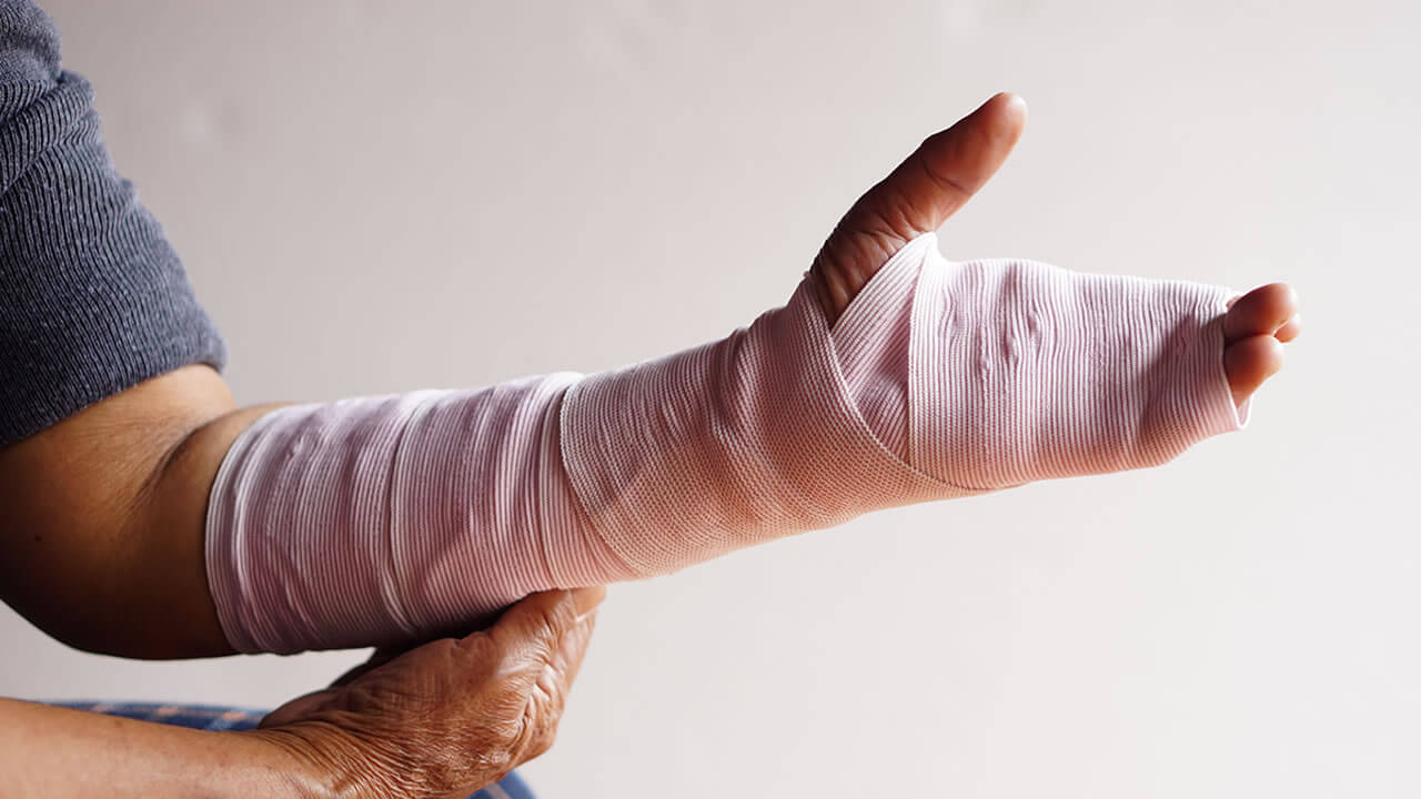 Quemaduras por accidente