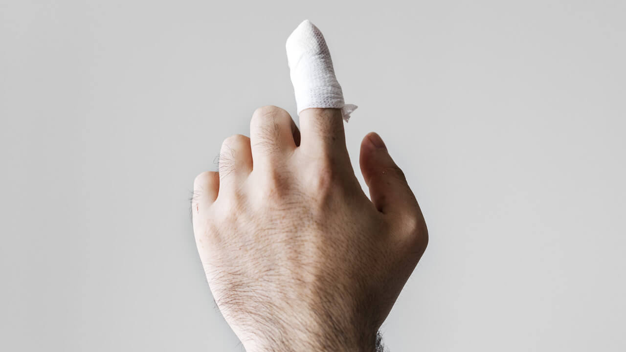 ¿Cómo lesionarse un dedo y qué hacer para recibir compensación?