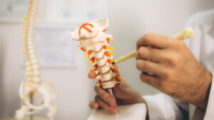 Discos de la columna desgastados: lesiones en construcciones