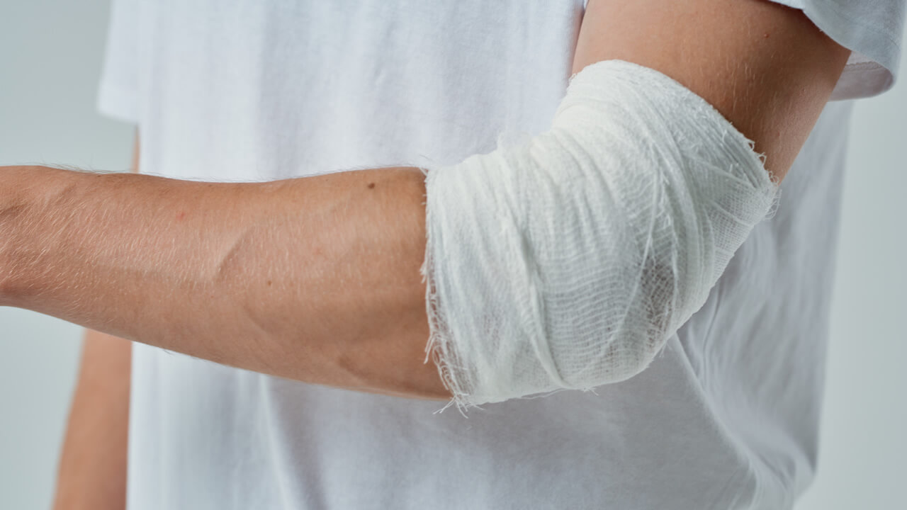Ligamento del brazo lastimado por trabajar en construcciones
