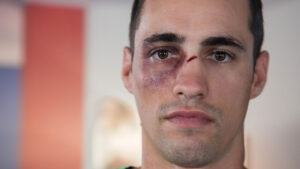 Demanda por lesiones en la cara en trabajos de construcción