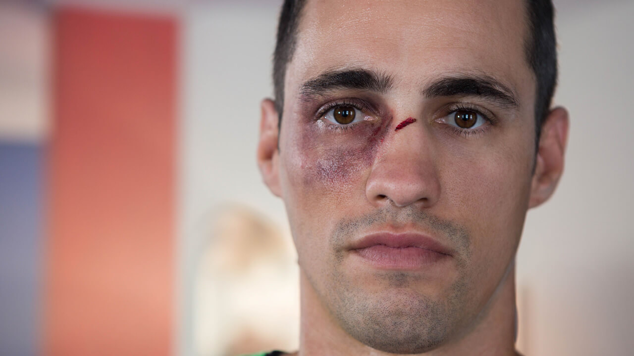 Demanda por lesiones en la cara en trabajos de construcción