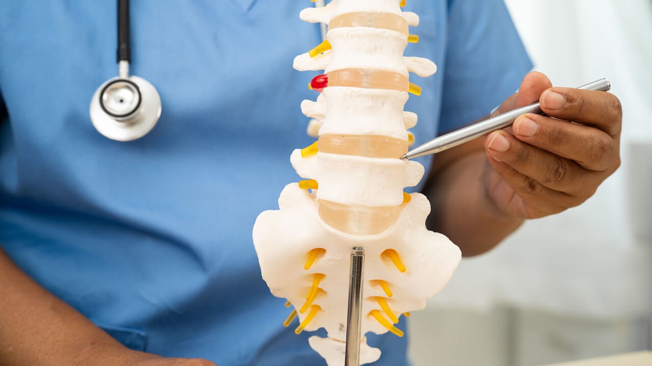 Porcentaje de incapacidad por hernia de disco L5-S1: qué significa para su caso en Nueva York
