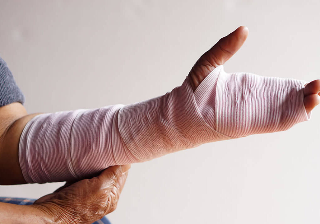 Quemaduras por accidente